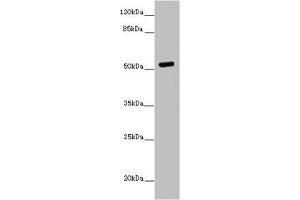 Western blot All lanes: PRMT3 antibody at 7 μg/mL + MCF-7 whole cell lysate Secondary Goat polyclonal to rabbit IgG at 1/10000 dilution Predicted band size: 60, 53 kDa Observed band size: 53 kDa (PRMT3 antibody  (AA 311-529))