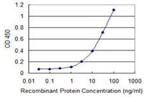 Detection limit for recombinant GST tagged SFTPC is 0. (Surfactant Protein C antibody  (AA 1-197))