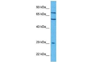 Host:  Rabbit  Target Name:  FZD7  Sample Tissue:  Human A549 Whole Cell  Antibody Dilution:  1ug/ml