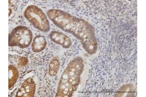 Immunoperoxidase of monoclonal antibody to NPR2 on formalin-fixed paraffin-embedded human stomach. (NPR2 antibody  (AA 131-230))