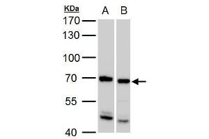 WB Image ADIP antibody [C3], C-term detects ADIP protein by western blot analysis. (SSX2IP antibody  (C-Term))