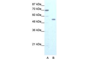 Western Blotting (WB) image for anti-Zinc Finger Protein 665 (ZNF665) antibody (ABIN2461273) (ZNF665 antibody)