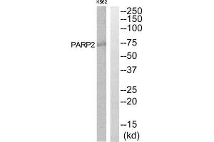 Western Blotting (WB) image for anti-Poly (ADP-Ribose) Polymerase 2 (PARP2) (Internal Region) antibody (ABIN1850490) (PARP2 antibody  (Internal Region))