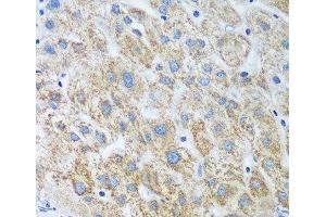 Immunohistochemistry of paraffin-embedded Human liver using UBE2U Polyclonal Antibody at dilution of 1:100 (40x lens). (UBE2U antibody)