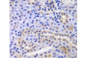 Immunohistochemistry of paraffin-embedded Mouse kidney using PSMA6 Polyclonal Antibody at dilution of 1:100 (40x lens). (PSMA6 antibody)