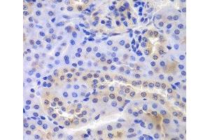 Immunohistochemistry of paraffin-embedded Mouse kidney using PSMA6 Polyclonal Antibody at dilution of 1:100 (40x lens). (PSMA6 antibody)