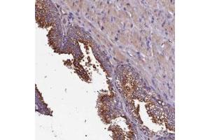 Immunohistochemical staining of human prostate with CLN5 polyclonal antibody  shows strong cytoplasmic positivity in glandular cells.