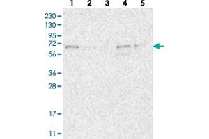 Western blot analysis of Lane 1: RT-4, Lane 2: U-251 MG, Lane 3: Human Plasma, Lane 4: Liver, Lane 5: Tonsil with FAM63A polyclonal antibody .