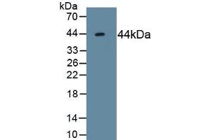 Detection of Recombinant ACVR2A, Human using Monoclonal Antibody to Activin A Receptor Type II A (ACVR2A) (ACVR2A antibody  (AA 20-135))