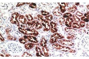 Immunohistochemistry of paraffin-embedded Human kidney tissue using CST3 Monoclonal Antibody at dilution of 1:200. (CST3 antibody)