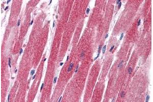 Human Heart: Formalin-Fixed, Paraffin-Embedded (FFPE) (SLUG antibody  (AA 92-141))