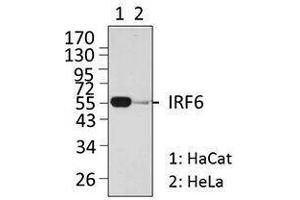 Western Blotting (WB) image for anti-Interferon Regulatory Factor 6 (IRF6) antibody (ABIN2665207) (IRF6 antibody)