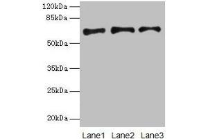 Western blot All lanes: PLAT antibody at 16 μg/mL Lane 1: Jurkat whole cell lysate Lane 2: Mouse stomach tissue Lane 3: Mouse kidney tissue Secondary Goat polyclonal to rabbit IgG at 1/10000 dilution Predicted band size: 63, 33, 58, 45 kDa Observed band size: 63 kDa