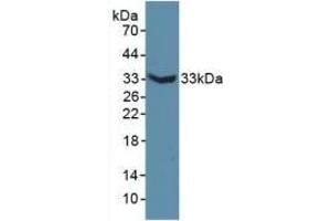 Detection of Recombinant MAP6, Mouse using Polyclonal Antibody to Microtubule Associated Protein 6 (MAP6) (MAP6 antibody  (AA 177-387))