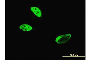 Immunofluorescence of monoclonal antibody to HLF on HeLa cell. (HLF antibody  (AA 1-295))