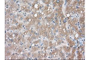 Immunohistochemical staining of paraffin-embedded Human liver tissue using anti-CYP1A2 mouse monoclonal antibody.