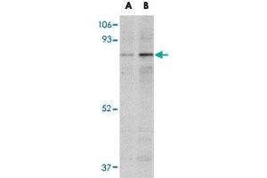 Western blot analysis of NAA35 in mouse heart tissue lysate with NAA35 polyclonal antibody  at (A) 1 and (B) 2 ug/mL . (MAK10/NAA35 antibody  (Internal Region))