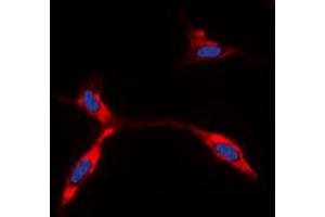 Immunofluorescent analysis of Kir6. (KCNJ11 antibody  (Center))