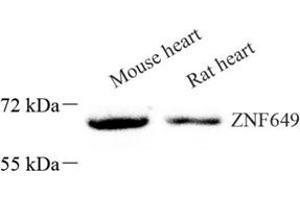 Western blot analysis of ZNF649 (ABIN7076269) at dilution of 1: 1000 (ZNF649 antibody)