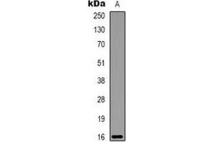 Western blot analysis of Alpha-lactalbumin expression in Milk (A) whole cell lysates. (LALBA antibody)