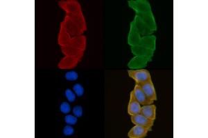 ABIN6258962 and ABIN6275051 staining Hela cells(30 min of UV treatment) by IF/ICC.