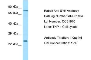 Western Blotting (WB) image for anti-Spleen tyrosine Kinase (SYK) (Middle Region) antibody (ABIN2788676) (SYK antibody  (Middle Region))