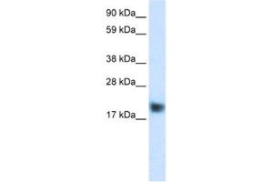 Western Blotting (WB) image for anti-Cysteine and Glycine-Rich Protein 3 (CSRP3) antibody (ABIN2460885)