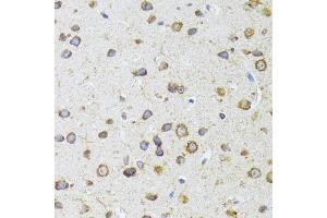 Immunohistochemistry of paraffin-embedded mouse brain using  antibody (ABIN6129960, ABIN6136680, ABIN6136681 and ABIN6224707) at dilution of 1:100 (40x lens). (AIFM3 antibody  (AA 1-200))