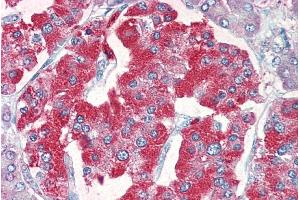 Immunohistochemistry (IHC) image for anti-Solute Carrier Family 18 (Vesicular Monoamine Transporter), Member 2 (SLC18A2) (C-Term) antibody (ABIN570915)