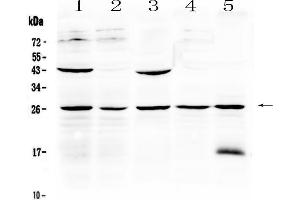 Western blot analysis of Noggin using anti-Noggin antibody . (NOG antibody  (AA 43-153))