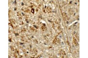 Immunohistochemical staining of mouse brain cells with ORMDL1 polyclonal antibody  at 5 ug/mL.
