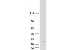 Small Ubiquitin Related Modifier 2 (SUMO2) (Transcript Variant 1) protein (Myc-DYKDDDDK Tag)