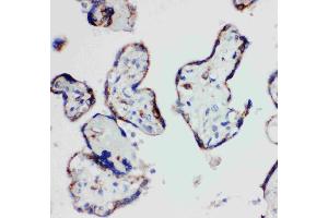 Anti-HSD17B1 antibody, IHC(P): Human Placenta Tissue (HSD17B1 antibody  (N-Term))