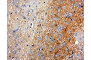 IHC-P analysis of Brain tissue, with DAB staining. (ACP5 antibody  (AA 79-318))
