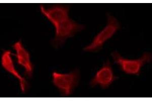 ABIN6276175 staining COLO205 by IF/ICC. (OR5P3 antibody  (Internal Region))