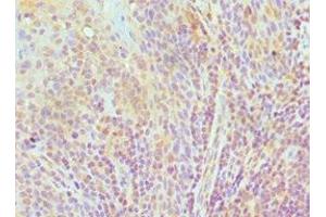 Immunohistochemistry of paraffin-embedded human tonsil tissue using ABIN7151592 at dilution of 1:100 (TCEB3 antibody  (AA 679-798))