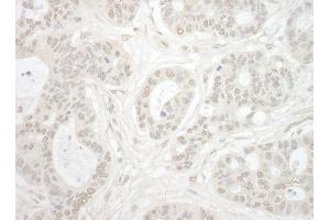 Immunohistochemistry (IHC) image for anti-Importin 4 (IPO4) (AA 350-400) antibody (ABIN7453529)