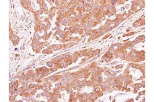 IHC-P Image Immunohistochemical analysis of paraffin-embedded OVCAR3 xenograft, using ASB4, antibody at 1:100 dilution.