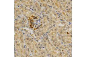 Immunohistochemistry (IHC) image for anti-Tumor Necrosis Factor Receptor Superfamily, Member 11b (TNFRSF11B) (AA 22-280) antibody (ABIN3022915)