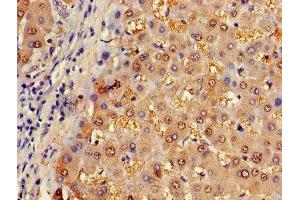 Immunohistochemistry of paraffin-embedded human liver tissue using ABIN7144595 at dilution of 1:100 (ASL antibody  (AA 2-300))