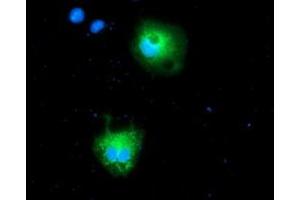 Anti-CALCOCO2 mouse monoclonal antibody (ABIN2454024) immunofluorescent staining of COS7 cells transiently transfected by pCMV6-ENTRY CALCOCO2 (RC203843). (CALCOCO2 antibody)