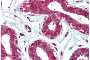 Human Breast (formalin-fixed, paraffin-embedded) stained with ITGA6 antibody ABIN462312 followed by biotinylated goat anti-rabbit IgG secondary antibody ABIN481713, alkaline phosphatase-streptavidin and chromogen. (ITGA6 antibody  (Ser1064))