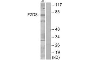 Western blot analysis of extracts from Jurkat cells, using FZD8 Antibody. (FZD8 antibody  (AA 31-80))