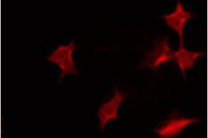 ABIN6267319 staining COS7 by IF/ICC. (Progesterone Receptor antibody  (pSer400))