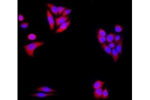 HeLa cells were stained with alpha-Synuclein Polyclonal Antibody, Unconjugated at 1:500 in PBS and incubated for two hours at 37°C followed by Goat Anti-Rabbit IgG (H+L) Cy3 conjugated secondary antibody. (SNCA antibody  (AA 1-140))