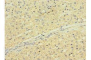 Immunohistochemistry of paraffin-embedded human adrenal gland tissue using ABIN7170303 at dilution of 1:100