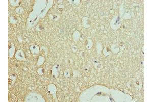 Immunohistochemistry of paraffin-embedded human brain tissue using ABIN7167017 at dilution of 1:100 (RPH3A antibody  (AA 1-280))