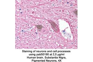 Image no. 1 for anti-Ubiquitin Carboxyl-terminal Esterase L1 (Ubiquitin Thiolesterase) (UCHL1) (AA 200-300) antibody (ABIN363499)