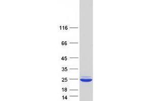 Validation with Western Blot (VMAC Protein (Myc-DYKDDDDK Tag))