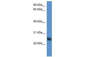 Western Blot showing SLA2 antibody used at a concentration of 1-2 ug/ml to detect its target protein. (SLAP2 antibody  (Middle Region))
